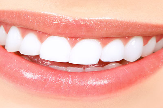 ssiimm imgxs2wf - روشهای سفید کردن دندان!