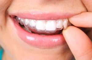 ssiimm istock 000019898070xsmall 300x197 - راههای حفظ سلامت دهان و دندان